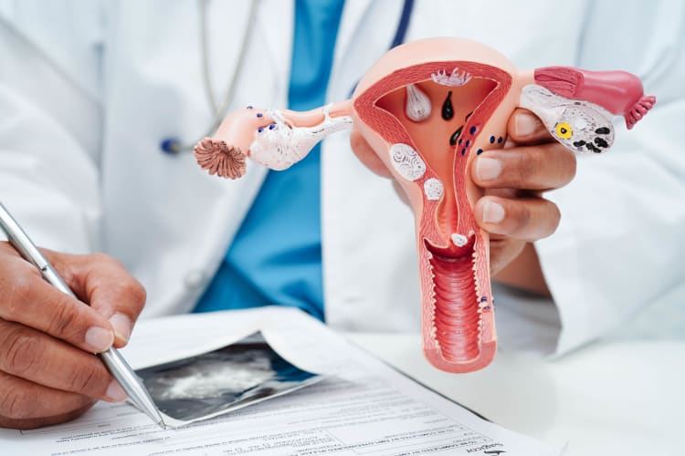A doctor holding a 3D replica of a woman's reproductive system